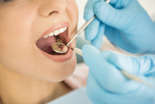 Why and when to benefit from dental crowns?